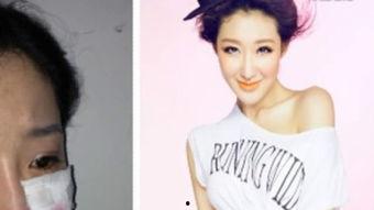 明星被咬,揭秘娱乐圈不为人知的秘密