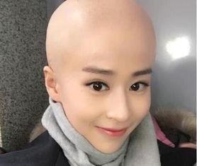 光头明星的图片,揭秘明星光头造型背后的故事